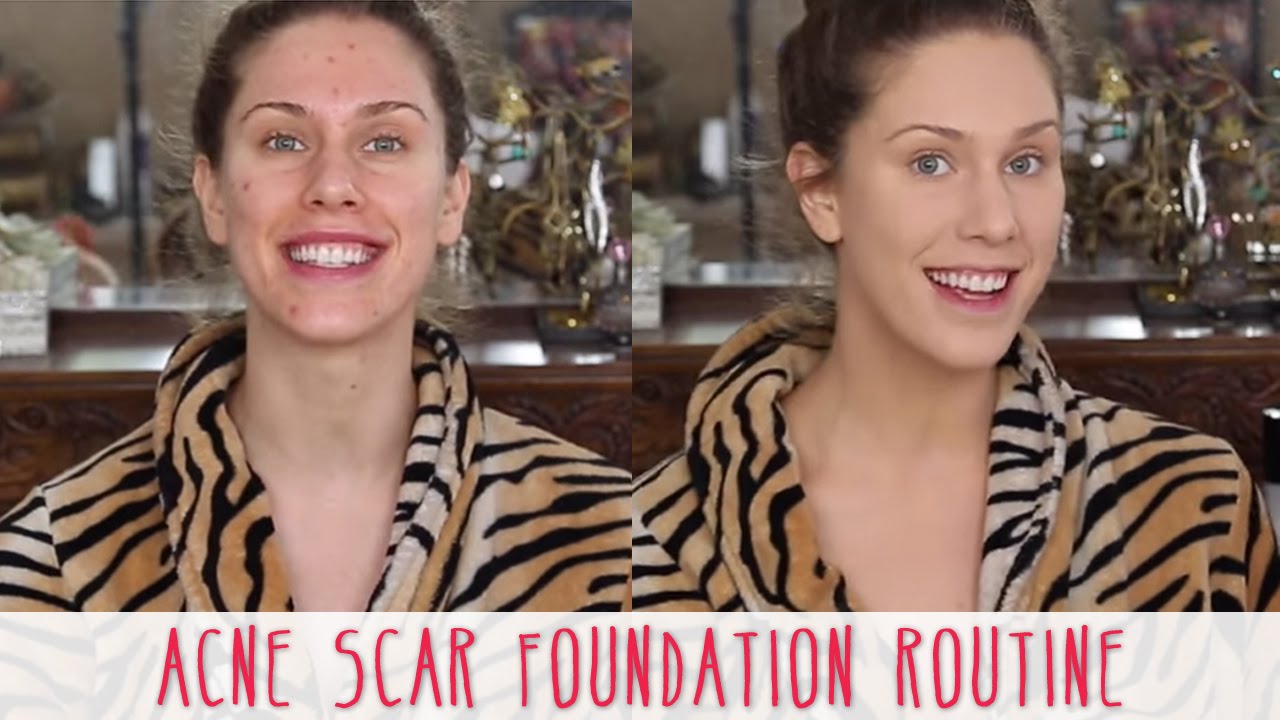 Acne Scar Foundation Routine Full Coverage Flawless Makeup